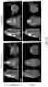 Fig. 54 - LIPOSOMAL SPHERICAL NUCLEIC ACID (SNA) CONSTRUCTS FOR SPLICE MODULATION