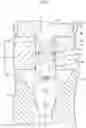 Fig. 04 - Nozzle and liquid ejection system