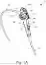 Fig. 02 - AUXILIARY OPERATION STRUCTURE OF ENDOSCOPE