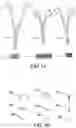 Fig. 02 - Surgical clip for simultaneous bleeding control of a blood vessel and cutting
