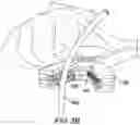 Fig. 08 - Surgical clip for simultaneous bleeding control of a blood vessel and cutting