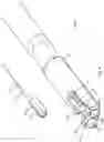 Fig. 06 - DEVICES AND METHODS FOR LEFT ATRIAL APPENDAGE CLOSURE