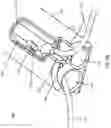 Fig. 08 - DEVICES AND METHODS FOR LEFT ATRIAL APPENDAGE CLOSURE