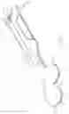 Fig. 03 - METHOD FOR PERFORMING AN ORTHOPAEDIC SURGICAL PROCEDURE