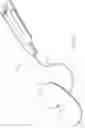 Fig. 11 - METHOD FOR PERFORMING AN ORTHOPAEDIC SURGICAL PROCEDURE