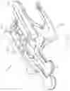 Fig. 23 - METHOD FOR PERFORMING AN ORTHOPAEDIC SURGICAL PROCEDURE