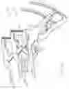 Fig. 27 - METHOD FOR PERFORMING AN ORTHOPAEDIC SURGICAL PROCEDURE