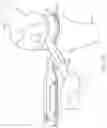 Fig. 35 - METHOD FOR PERFORMING AN ORTHOPAEDIC SURGICAL PROCEDURE