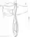Fig. 37 - METHOD FOR PERFORMING AN ORTHOPAEDIC SURGICAL PROCEDURE