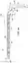 Fig. 07 - Intraosseous sliding osteotomy system and method