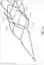 Fig. 08 - Visibility of Mechanical Thrombectomy Device During Diagnostic Imaging