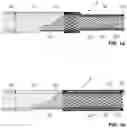 Fig. 02 - Apparatus and method for neurovascular endoluminal intervention