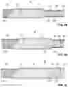 Fig. 06 - Apparatus and method for neurovascular endoluminal intervention