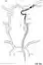 Fig. 22 - Apparatus and method for neurovascular endoluminal intervention