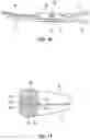 Fig. 09 - VESSEL SEALING DEVICE WITH FINE DISSECTION FUNCTION