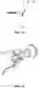 Fig. 08 - Prepuce extruding, cutting, hemostasis, and healing assembly using ultrasonic wave