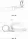 Fig. 35 - Prepuce extruding, cutting, hemostasis, and healing assembly using ultrasonic wave