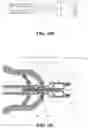 Fig. 49 - Prepuce extruding, cutting, hemostasis, and healing assembly using ultrasonic wave