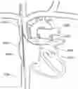 Fig. 01 - Steerable endoluminal punch with cutting stylet