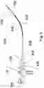 Fig. 06 - Steerable endoluminal punch with cutting stylet
