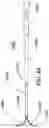 Fig. 46 - Steerable endoluminal punch with cutting stylet