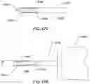 Fig. 48 - Steerable endoluminal punch with cutting stylet