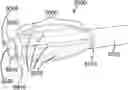 Fig. 01 - DEVICES, SYSTEMS, AND METHODS FOR USE WITH SUCTION WITHIN A MAMMALIAN BODY