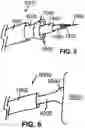 Fig. 04 - DEVICES, SYSTEMS, AND METHODS FOR USE WITH SUCTION WITHIN A MAMMALIAN BODY