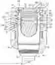 Fig. 01 - SPLAY CONTROL CLOSURE FOR OPEN BONE ANCHOR