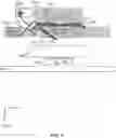 Fig. 03 - MEDICAL STABILIZATION APPARATUS