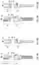 Fig. 05 - PEDICLE SCREW HAVING A REMOVABLE ROD COUPLING