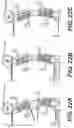 Fig. 16 - PEDICLE SCREW HAVING A REMOVABLE ROD COUPLING