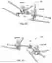 Fig. 17 - PEDICLE SCREW HAVING A REMOVABLE ROD COUPLING