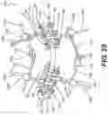 Fig. 20 - PEDICLE SCREW HAVING A REMOVABLE ROD COUPLING