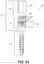 Fig. 44 - PEDICLE SCREW HAVING A REMOVABLE ROD COUPLING