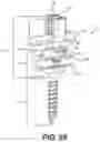 Fig. 45 - PEDICLE SCREW HAVING A REMOVABLE ROD COUPLING