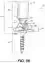 Fig. 46 - PEDICLE SCREW HAVING A REMOVABLE ROD COUPLING