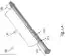 Fig. 02 - INTRAMEDULLARY FIXATION DEVICE WITH SHAPE LOCKING INTERFACE
