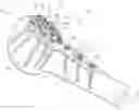 Fig. 01 - Humeral fixation plates