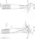 Fig. 12 - Humeral fixation plates