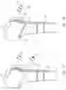 Fig. 24 - Humeral fixation plates