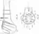 Fig. 26 - Humeral fixation plates