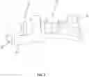 Fig. 03 - SYSTEM AND METHOD FOR BONE FIXATION