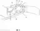 Fig. 04 - SYSTEM AND METHOD FOR BONE FIXATION