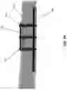 Fig. 25 - SYSTEM AND METHOD FOR BONE FIXATION
