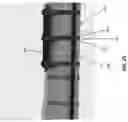 Fig. 26 - SYSTEM AND METHOD FOR BONE FIXATION
