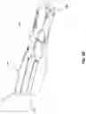 Fig. 29 - SYSTEM AND METHOD FOR BONE FIXATION