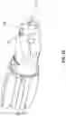 Fig. 34 - SYSTEM AND METHOD FOR BONE FIXATION