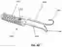 Fig. 40 - SYSTEM AND METHOD FOR BONE FIXATION