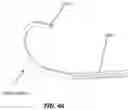 Fig. 46 - SYSTEM AND METHOD FOR BONE FIXATION
